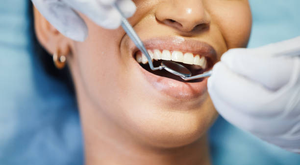 Best Emergency Tooth Extraction in Olivet, TN